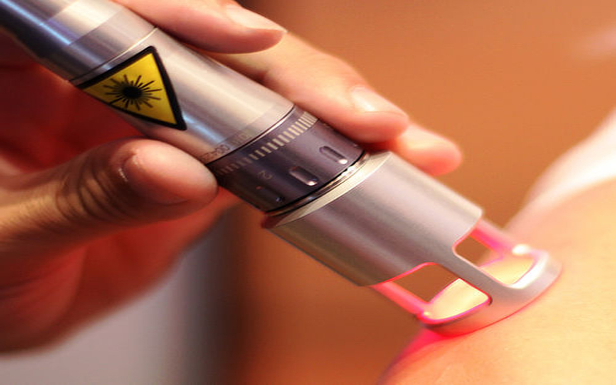 Laser Therapy Sagars Rehab Soft Tissue Therapy Exercise Therapy